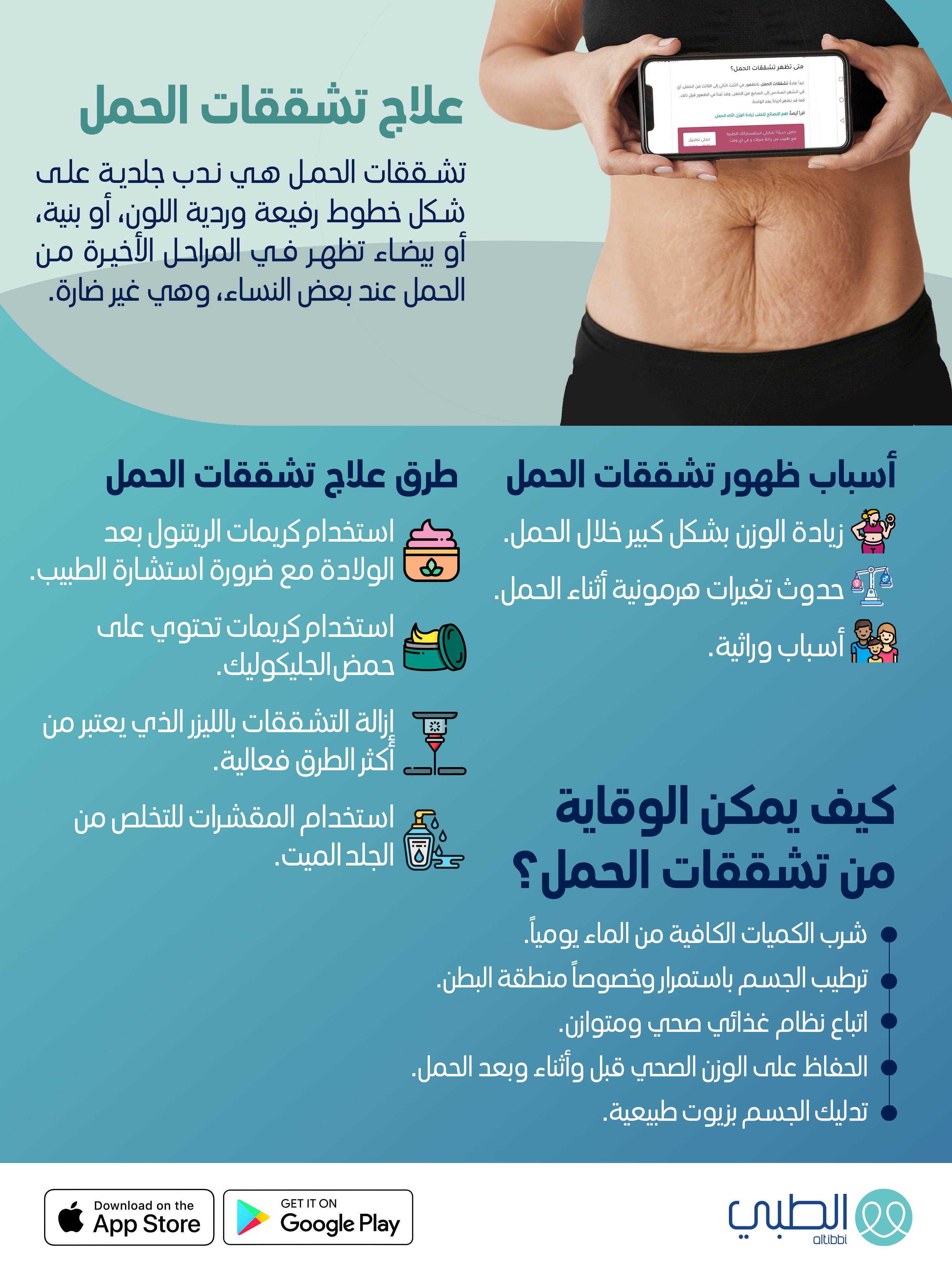 علاج تشققات الحمل