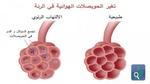 في اليوم العالمي للالتهاب الرئوي : عدوى يسهل