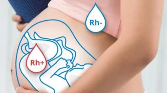 كل ما تحتاج معرفته عن ابرة Rh فصيلة الدم