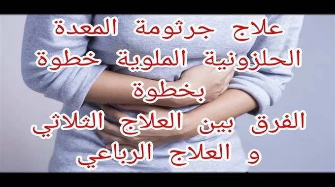 أسرار العلاج الثلاثي لجرثومة المعدة